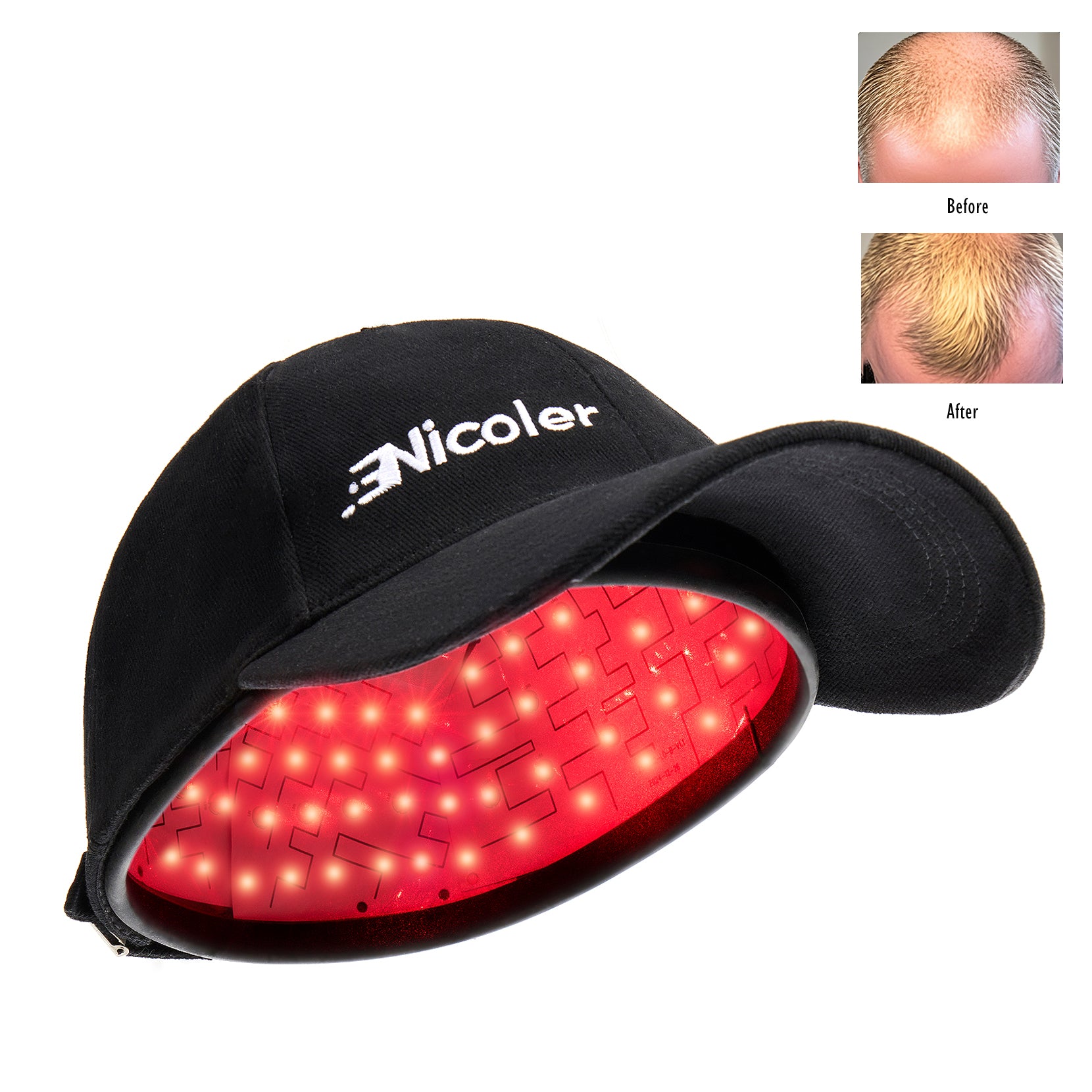 Laser Therapy Cap for Hair Regrowth