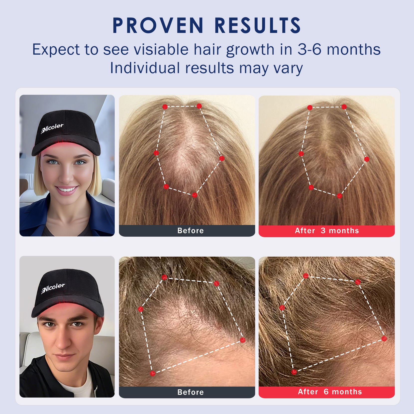 Laser Therapy Cap for Hair Regrowth
