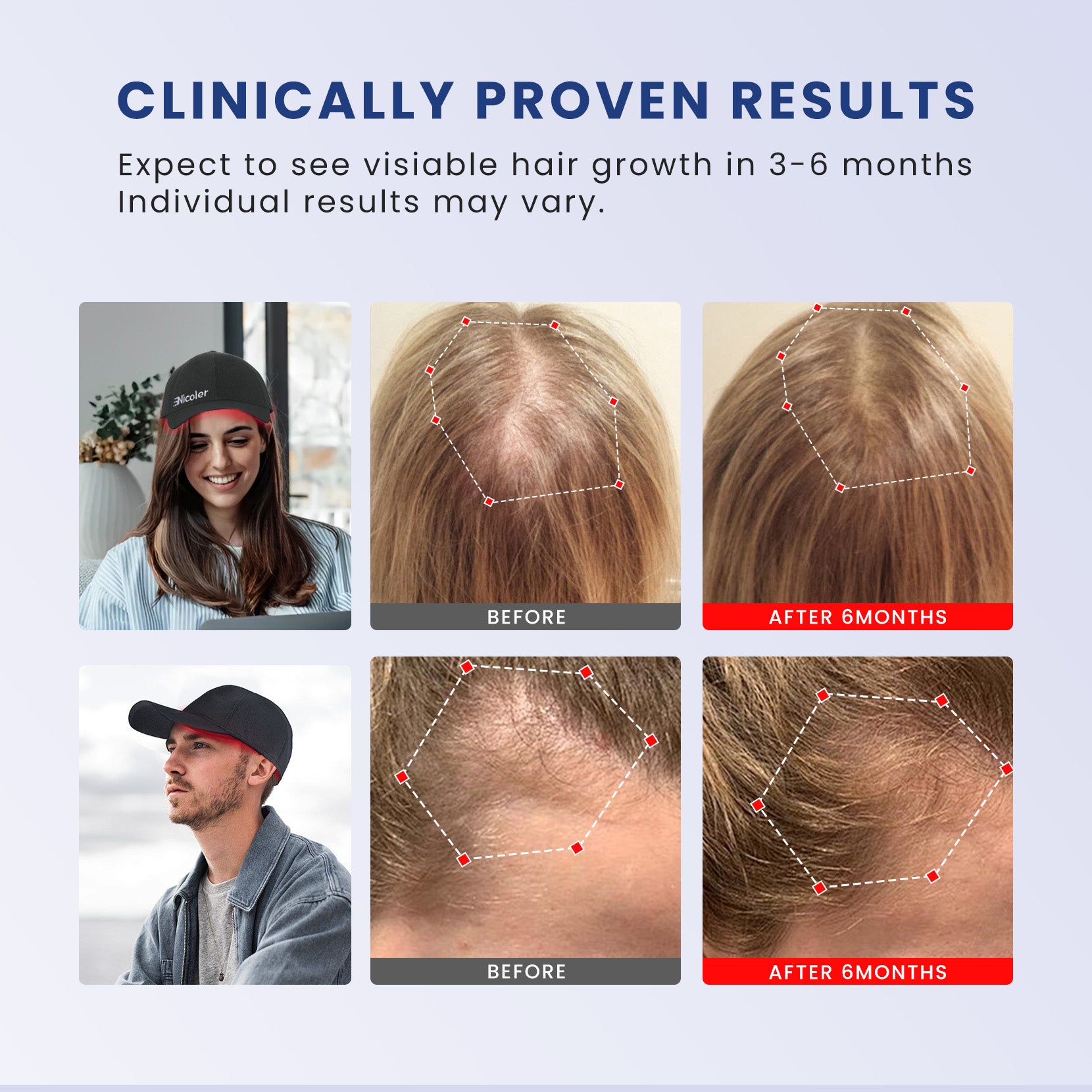 Laser Therapy Cap for Hair Regrowth